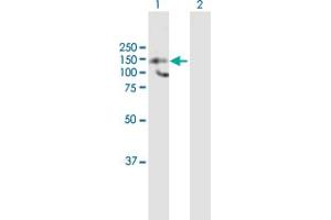 Western Blot analysis of HDAC9 expression in transfected 293T cell line by HDAC9 MaxPab polyclonal antibody. (HDAC9 anticorps  (AA 1-1069))