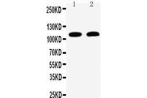 Anti-Desmoglein 3 antibody, Western blotting Lane 1: A431 Cell Lysate Lane 2: CEM Cell Lysate (Desmoglein 3 anticorps  (C-Term))