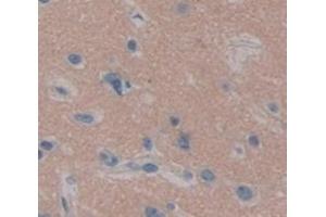 Used in DAB staining on fromalin fixed paraffin- embedded Kidney tissue
