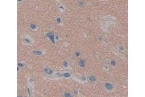 Used in DAB staining on fromalin fixed paraffin- embedded Kidney tissue (UBE2K anticorps  (AA 2-200))