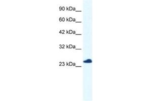 Western Blotting (WB) image for anti-Chromosome 14 Open Reading Frame 166 (C14orf166) antibody (ABIN2460980)