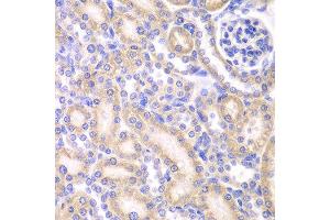 Immunohistochemistry of paraffin-embedded rat kidney using AK4 antibody at dilution of 1:200 (400x lens). (AK4 anticorps)