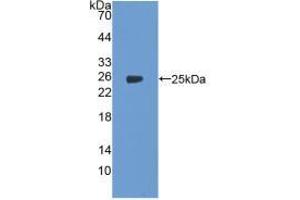 Figure. (PTGS2 anticorps  (AA 418-589))