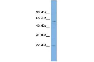 WB Suggested Anti-FTO Antibody Titration:  0. (FTO anticorps  (Middle Region))