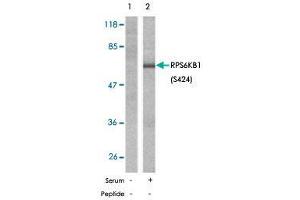 Western blot analysis of extracts from 293 cells, untreated or treated with serum (10 %, 10 min), using RPS6KB1 (phospho S424) polyclonal antibody .