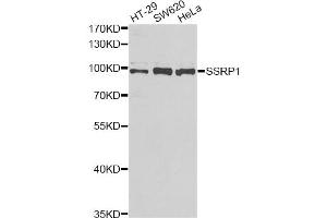Western blot analysis of extracts of various cell lines, using SSRP1 antibody (ABIN5973814) at 1/1000 dilution. (SSRP1 anticorps)