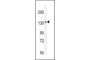 Antibody (C-term) (ABIN654917 and ABIN2844562) western blot analysis in mouse spleen tissue lysates (35 μg/lane). (K1199 anticorps  (C-Term))