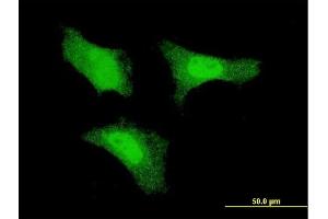Immunofluorescence of monoclonal antibody to FGF1 on HeLa cell. (FGF1 anticorps  (AA 46-155))