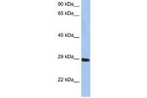 Crystallin Beta A1 antibody used at 1 ug/ml to detect target protein. (CRYBA1 anticorps  (N-Term))