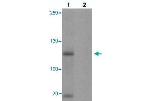Western blot analysis of MYT1L in mouse brain tissue with MYT1L polyclonal antibody  at 1 ug/mL in (1) the absence and (2) the presence of blocking peptide. (MYT1L anticorps  (C-Term))