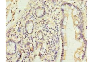Immunohistochemistry of paraffin-embedded human small intestine tissue using ABIN7165622 at dilution of 1:100 (C17orf66 anticorps  (AA 1-219))