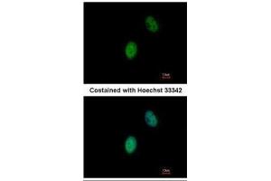 ICC/IF Image Immunofluorescence analysis of paraformaldehyde-fixed HeLa, using FHL5, antibody at 1:500 dilution. (FHL5 anticorps)
