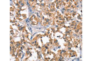 Immunohistochemistry (IHC) image for anti-Hepatocyte Growth Factor (Hepapoietin A, Scatter Factor) (HGF) antibody (ABIN2428213) (HGF anticorps)