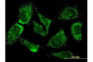 Immunofluorescence of monoclonal antibody to MOGAT3 on HeLa cell.
