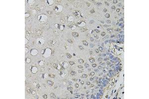 Immunohistochemistry of paraffin-embedded human esophagus using AMPD1 antibody. (AMPD1 anticorps)