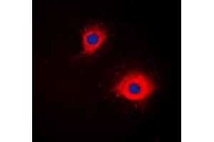 Immunofluorescent analysis of CD254 staining in Jurkat cells. (RANKL anticorps  (Center))