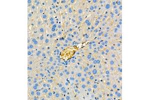 Immunohistochemistry of paraffin embedded mouse liver using ApoA2 (ABIN7073083) at dilution of 1:650 (300x lens) (APOA2 anticorps)