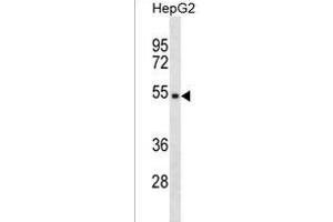 TPE Antibody (Center) (ABIN1537828 and ABIN2838253) western blot analysis in HepG2 cell line lysates (35 μg/lane). (TMPPE anticorps  (AA 133-161))