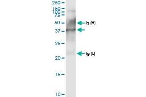 Immunoprecipitation of PECI transfected lysate using anti-PECI MaxPab rabbit polyclonal antibody and Protein A Magnetic Bead , and immunoblotted with PECI MaxPab rabbit polyclonal antibody (D01) .