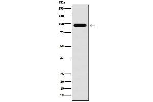 Western blot analysis of RanBP9 expression in HeLa cell lysate.