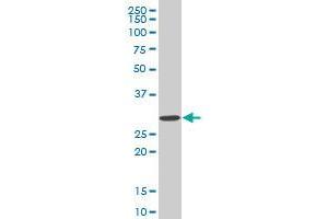 SIX3 monoclonal antibody (M02), clone 3F1. (SIX3 anticorps  (AA 273-332))