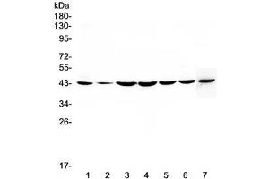 Western blot testing of human 1) HeLa, 2) placenta, 3) COLO-320, 4) PANC-1, 5) HepG2, 6) MDA-MB-231 and 7) mouse NIH3T3 lysate with FLIP antibody at 0. (FLIP anticorps  (AA 1-376))