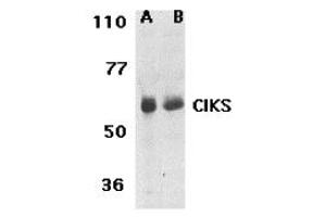 Western Blotting (WB) image for anti-TRAF3 Interacting Protein 2 (TRAF3IP2) (N-Term) antibody (ABIN1031321)