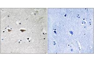 Immunohistochemistry (IHC) image for anti-Proto-oncogene tyrosine-protein kinase Src (Src) (AA 41-90) antibody (ABIN2889119) (Src anticorps  (AA 41-90))