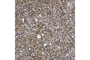 IHC analysis of SETD3 using anti-SETD3 antibody (ABIN7600293). (SETD3 anticorps  (AA 173-468))