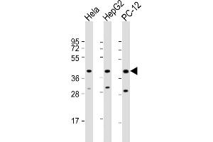 All lanes : Anti-PK14 Antibody  at 1:2000 dilution Lane 1: Hela whole cell lysate Lane 2: HepG2 whole cell lysate Lane 3: PC-12 whole cell lysate Lysates/proteins at 20 μg per lane. (MAPK14 anticorps  (AA 301-330))