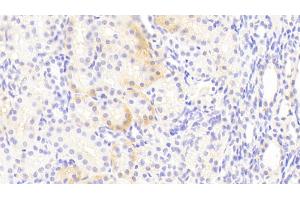 Detection of EAAT3 in Human Kidney Tissue using Polyclonal Antibody to Excitatory Amino Acid Transporter 3 (EAAT3)