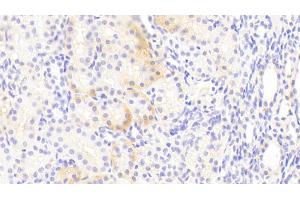 Detection of EAAT3 in Human Kidney Tissue using Polyclonal Antibody to Excitatory Amino Acid Transporter 3 (EAAT3) (SLC1A1 anticorps  (AA 115-209))