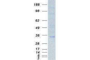 Validation with Western Blot