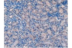 IHC-P analysis of Mouse Kidney Tissue, with DAB staining. (SOD2 anticorps  (AA 25-222))