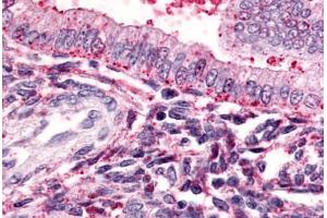 Anti-TBXA2R antibody  ABIN1049407 IHC staining of human uterus. (TBXA2R anticorps  (Cytoplasmic Domain))