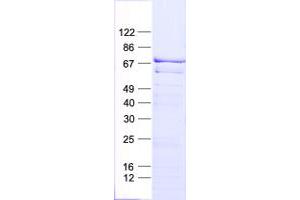 Validation with Western Blot