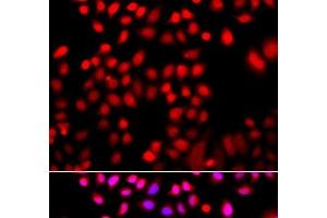 Immunofluorescence analysis of A549 cells using CFL2 Polyclonal Antibody (Cofilin 2 anticorps)