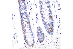 Immunohistochemistry of paraffin-embedded human colon using Thioredoxin 1 (Trx1/TXN) Rabbit mAb (ABIN1679926, ABIN3018425, ABIN3018426 and ABIN7101611) at dilution of 1:100 (40x lens).