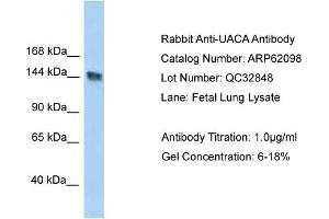 Western Blotting (WB) image for anti-UACA (UACA) (C-Term) antibody (ABIN2774333) (UACA anticorps  (C-Term))