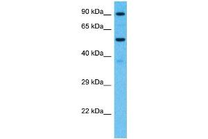 Host:  Rabbit  Target Name:  PCDHB7  Sample Type:  Fetal Kidney lysates  Antibody Dilution:  1. (PCDHb7 anticorps  (Middle Region))