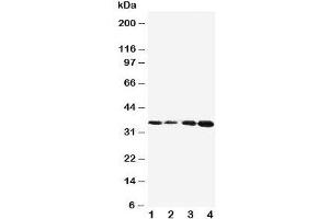 Western blot testing of Protein C antibody and Lane 1:  Jurkat;  2: CEM;  3: SMMC-7721;  4: HeLa cell lysate. (PROC anticorps  (AA 446-461))
