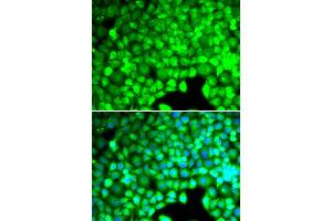 Immunofluorescence analysis of U20S cell using CYTH2 antibody. (Cytohesin 2 anticorps)