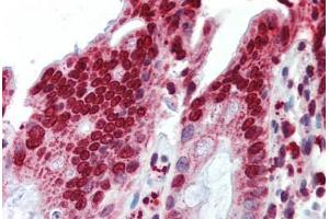 Human Colon (formalin-fixed, paraffin-embedded) stained with BXDC5 antibody ABIN462228 followed by biotinylated goat anti-rabbit IgG secondary antibody ABIN481713, alkaline phosphatase-streptavidin and chromogen.