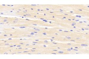 Detection of ERRb in Mouse Cardiac Muscle Tissue using Polyclonal Antibody to Estrogen Related Receptor Beta (ERRb) (ESRRB anticorps  (AA 166-438))