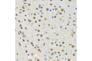Immunohistochemistry of paraffin-embedded rat brain using SPIN1 antibody (ABIN2560112) at dilution of 1:100 (40x lens). (Spindlin 1 anticorps)