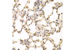 Immunohistochemistry of paraffin-embedded rat lung using SFN Antibody. (14-3-3 sigma/SFN anticorps  (AA 1-248))