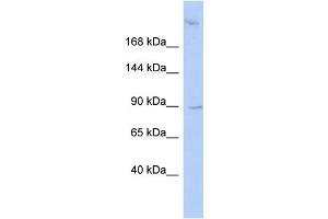 WB Suggested Anti-OSBPL3 Antibody Titration:  0. (OSBPL3 anticorps  (N-Term))