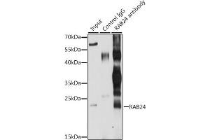 Immunoprecipitation analysis of 200 μg extracts of MCF-7 cells, using 3 μg R antibody (ABIN6132225, ABIN6146561, ABIN6146562 and ABIN6224440). (RAB24 anticorps  (AA 1-203))