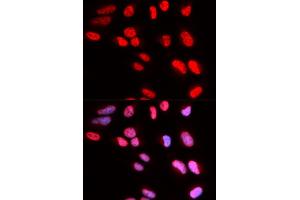 Immunofluorescence analysis of U2OS cells using PRPF3 antibody (ABIN5973192). (PRPF3 anticorps)