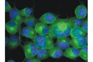 Immunofluorescence staining (mouse neuroblastoma cells) Immunofluorescence staining of Neuro2a mouse neuroblastoma cell line using anti-betaIII-tubulin (TU-20 ; green; 3 μg/ml). (TUBB3 anticorps  (N-Term) (FITC))